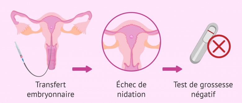 Est Ce Quon Ressent La Nidation Planetefemmes Magazine Dinformations Pour Les Femmes Et 